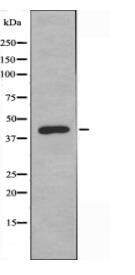 M-CK Antibody