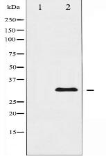 hnRNP C1/2 Antibody