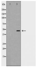 Keratin 17 Antibody