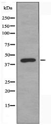 TBPL2 Antibody