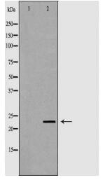 NEUROG3 Antibody