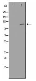 STAT5B Antibody