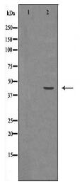 HSD3B2 Antibody