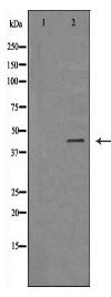 IL2RG Antibody