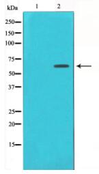 Estrogen Receptor-alpha Antibody