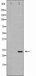 ORM1 Antibody