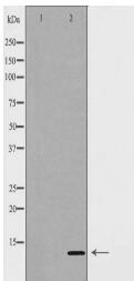 SUMO4 Antibody