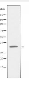 MMTAG2 Antibody