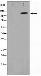 Collagen IV Antibody