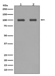 Aconitase 1 Antibody