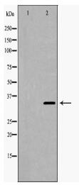 STUB1 Antibody