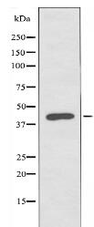 Prostacyclin Receptor Antibody