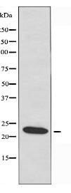 RAB2B Antibody