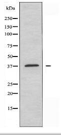 ZDHHC15 Antibody