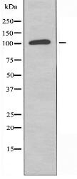 RAB3GAP1 Antibody