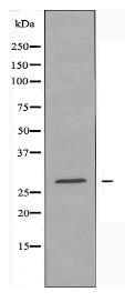 TMEM101 Antibody