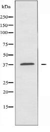 TUSC3 Antibody