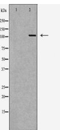 PARP1 Antibody