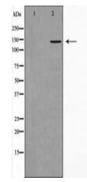 Collagen II Antibody