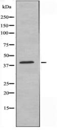 MC5R Antibody