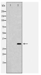 NQO1 Antibody