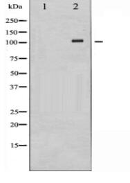 Retinoblastoma Antibody