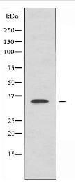 OR51B5 Antibody