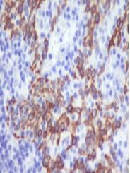 CCR2/CKR2Antibody