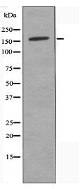 PNPLA6 Antibody