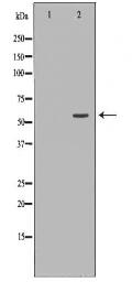 IFNAR2 Antibody