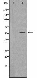 ZSCAN22 Antibody