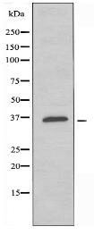 OR6K2 Antibody