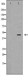 PSMC6 Antibody