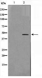 CEBPB Antibody