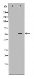 KRT8 Antibody