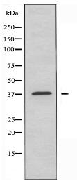 PARD6B Antibody