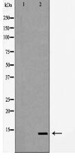 Synuclein β Antibody