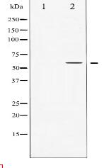 Tyrosine Hydroxylase Antibody