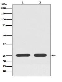 RAB33B Antibody