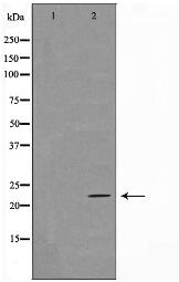 TFIP8 Antibody