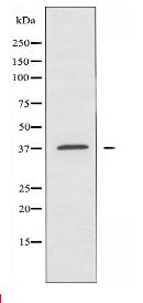 SUCNR1 Antibody