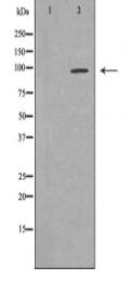 MUSK Antibody