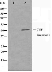 TNFR1 Antibody