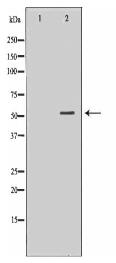 UGDH Antibody