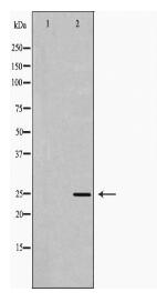 RAN Antibody