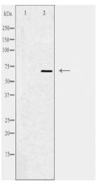 SLC5A6 Antibody