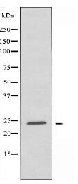 TCEAL6 Antibody