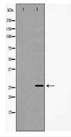 NQO2 Antibody