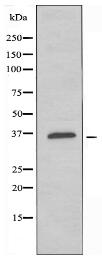 OR5K3 Antibody