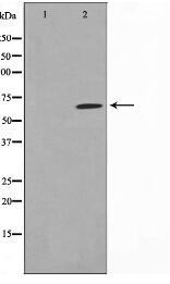 PIAS1 Antibody